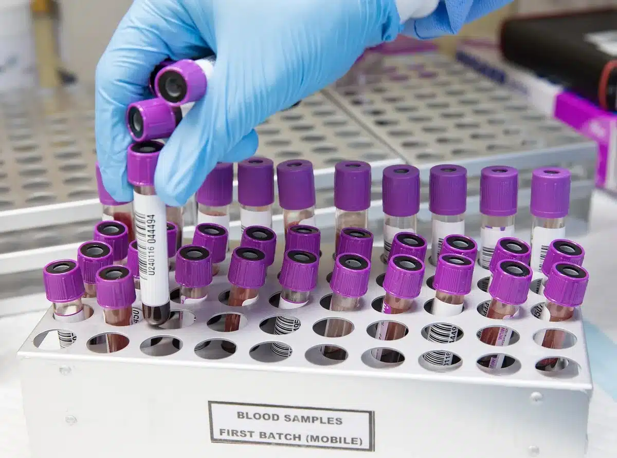 Prélèvement sanguin et tubes de laboratoire pour numération formule sanguine