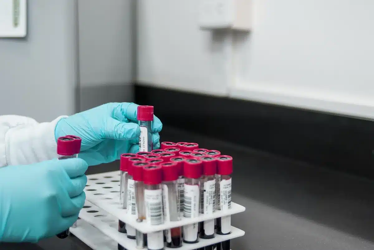 Professionnel de santé analysant les résultats d'une prise de sang sur un ordinateur