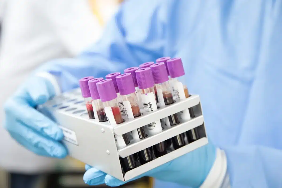 Tubulures et échantillons sanguins posés à côté de fiches de résultats