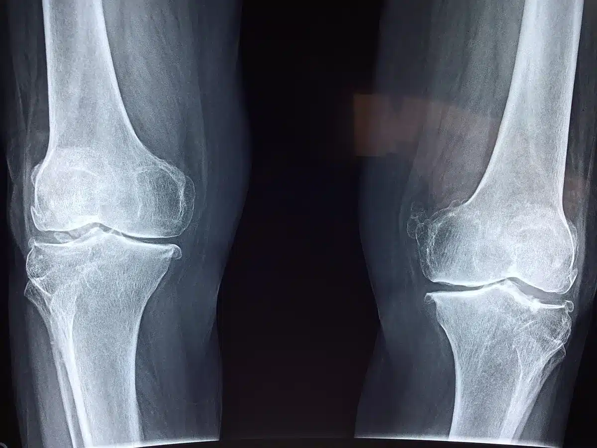Schéma simplifié montrant collagène, cartilage et tendons