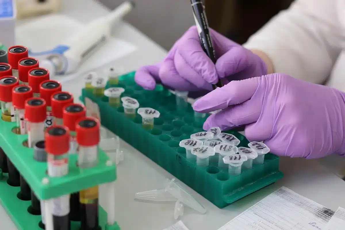 Tube de prélèvement sanguin et résultats de laboratoire sur une table